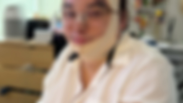 A PREVIEW OF BRIE'S NEW FACE AFTER FFS!!!!!