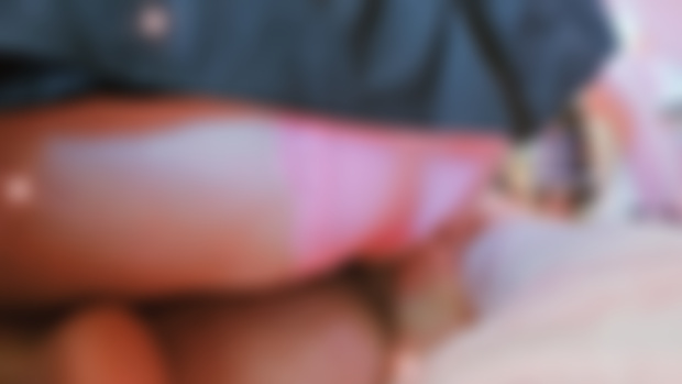 🍑