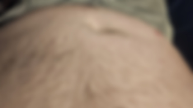 Belly