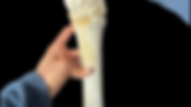 Limb Deviations