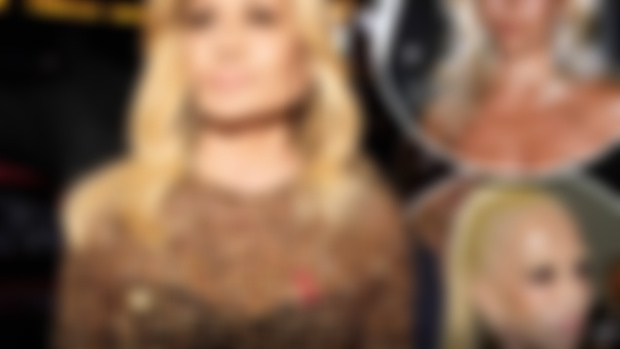 Has Donatella Versace undergone another plastic surgery?