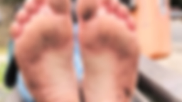 Freezing filthy: the best close-ups