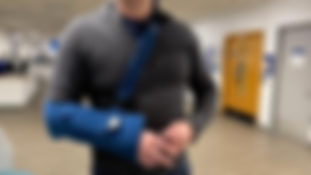 Whoops. Dislocated shoulder!