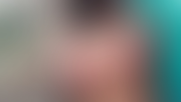 Teaser Post