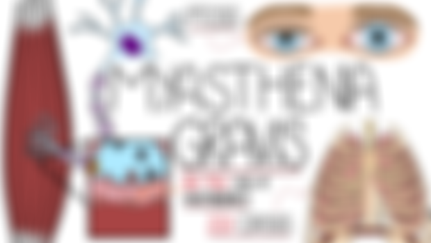 Myasthenia Gravis