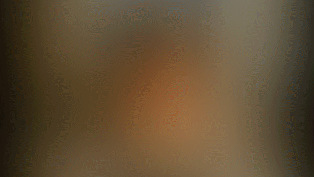 Patient waiting (Animation below)