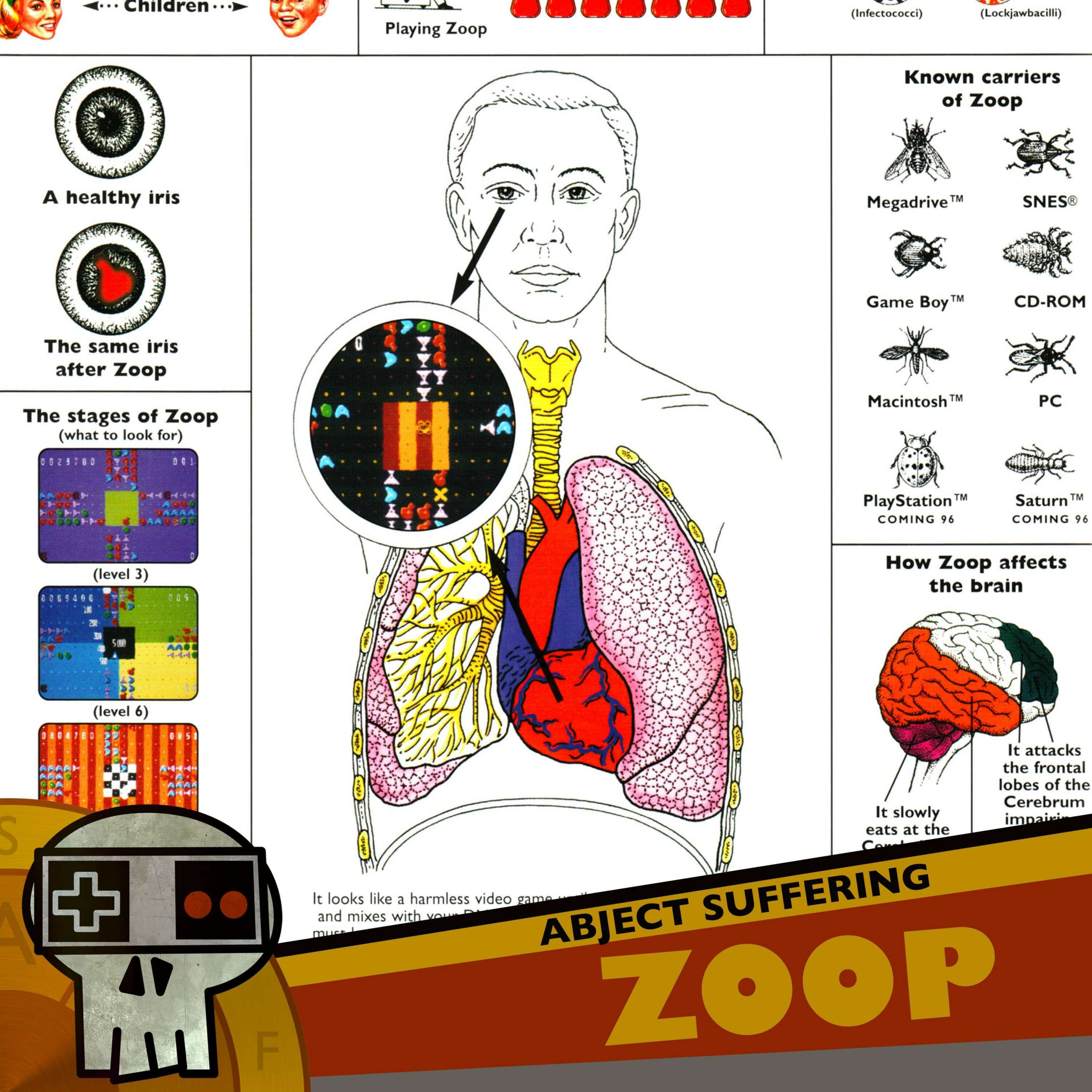 Abject Suffering 462: Zoop