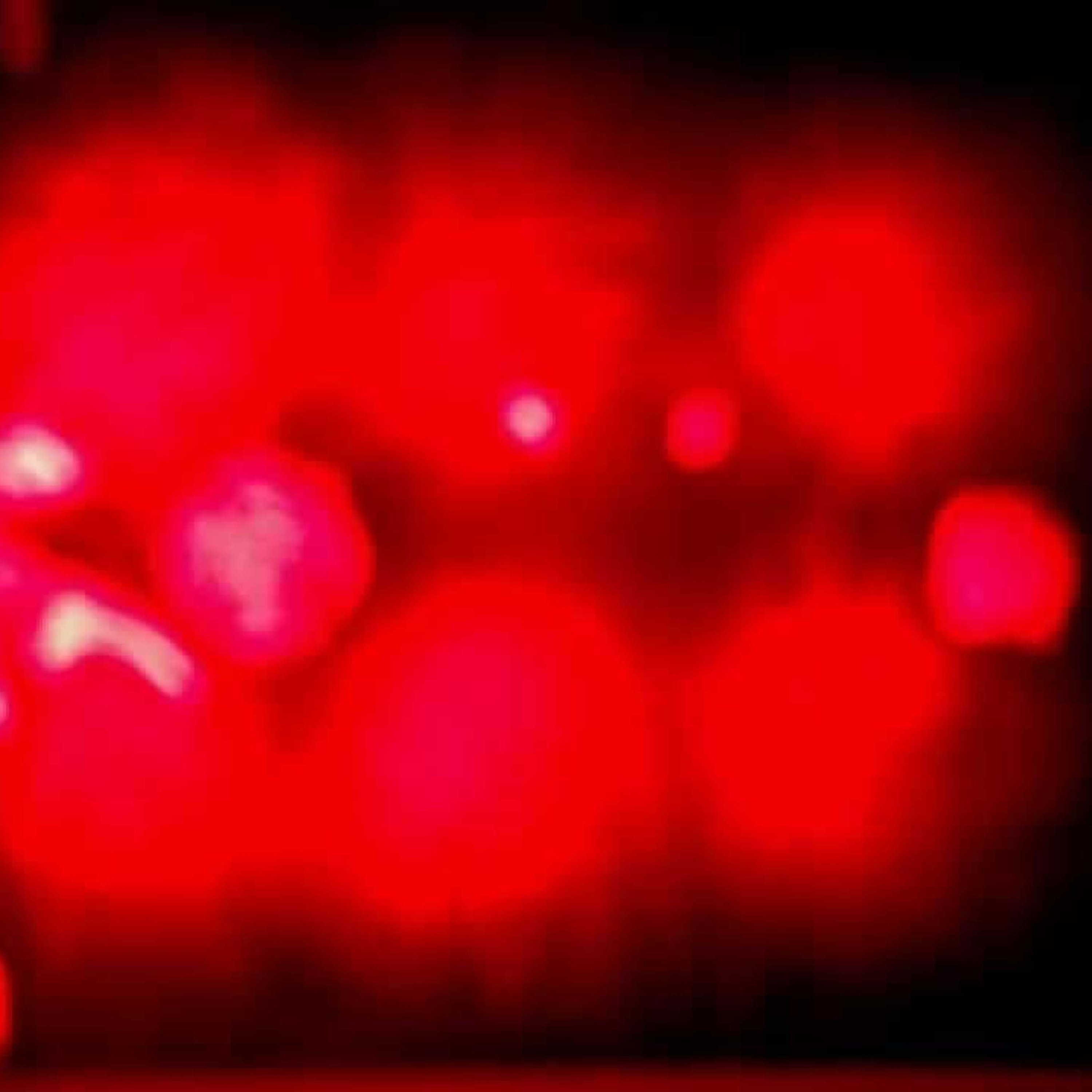 Abject Suffering 123: The R-Zone Zone