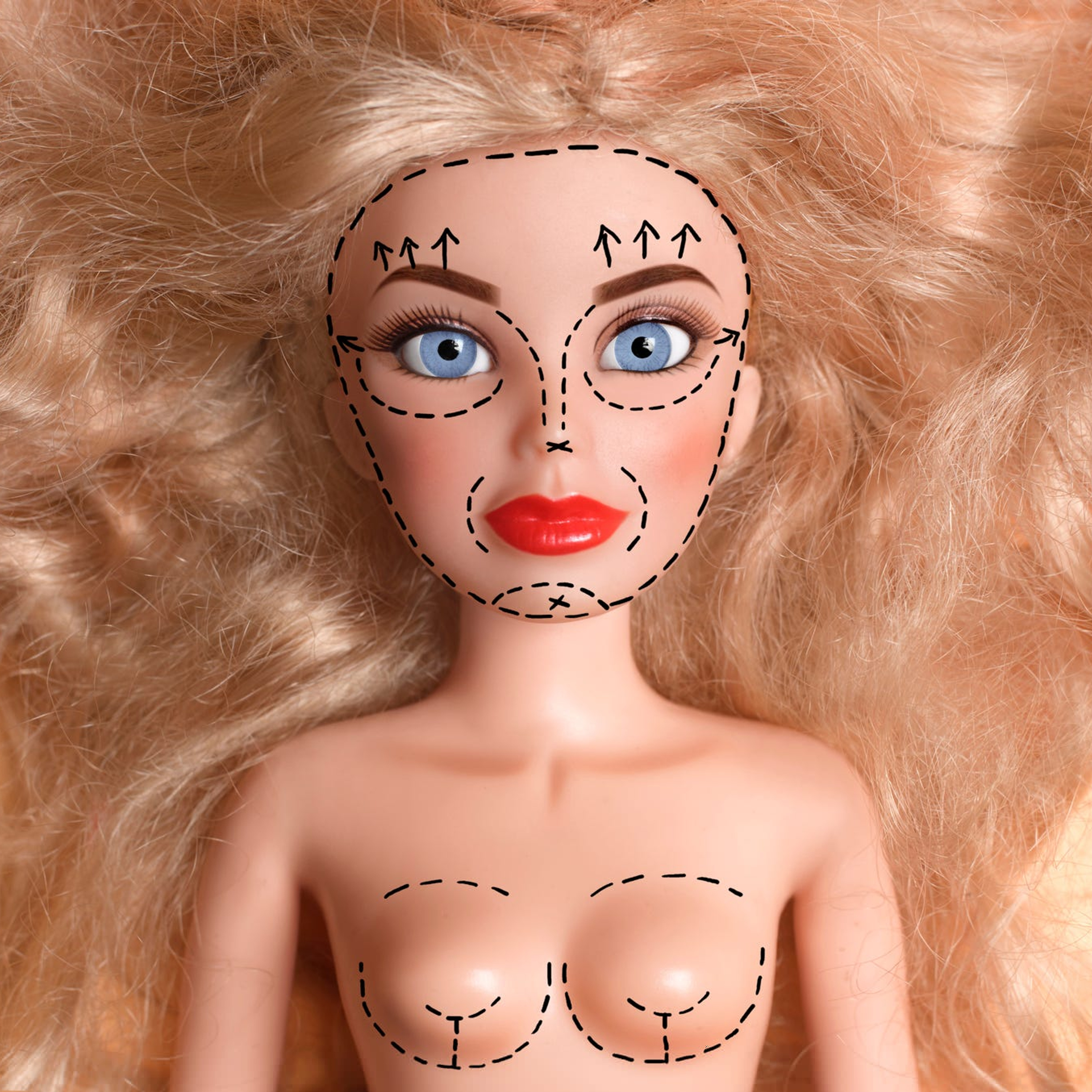 Complicating the Plastic Surgery Conversation