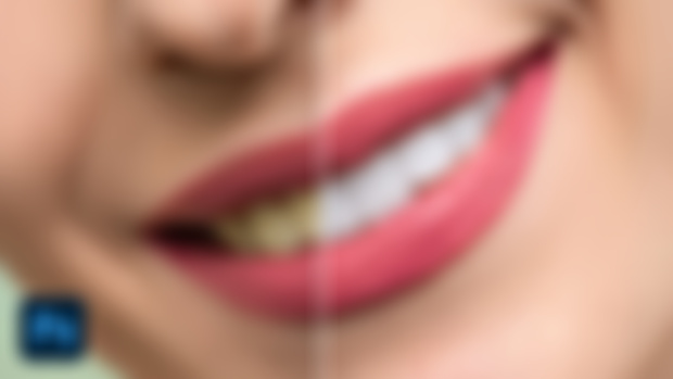 Teeth Whitening Photoshop Action