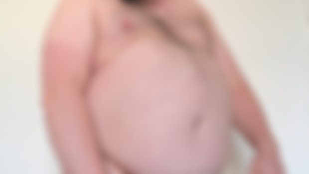 Instagram Removed My Picture