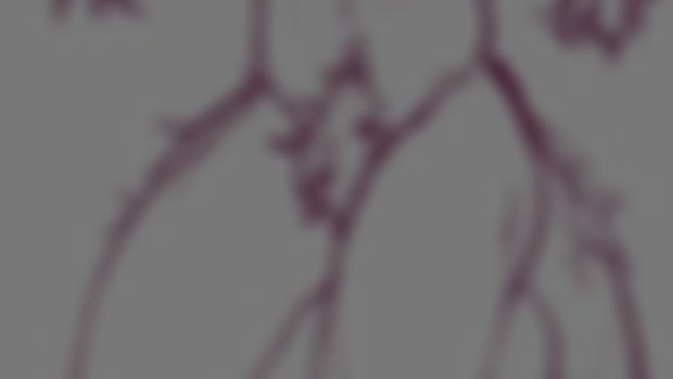 Iroh Daki WIP